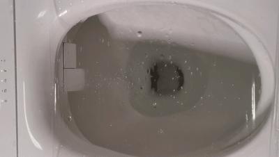 舒服如厕的正确打开方式,如厕通畅小妙招