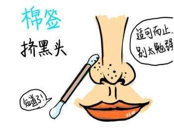 有效去黑头闭口粉刺收缩毛孔,收缩毛孔清洁黑头闭口粉刺