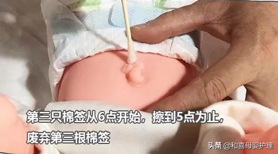 新生儿脐带一个月还没掉正常吗,新生儿脐带一个月没掉正常吗