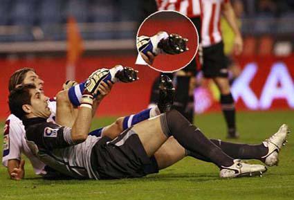 戈麦斯断腿事件结果,英超戈麦斯