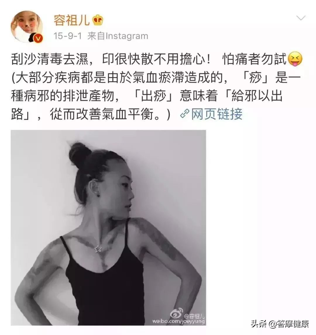 年过三十面部下垂，告诉你提拉紧致的秘技