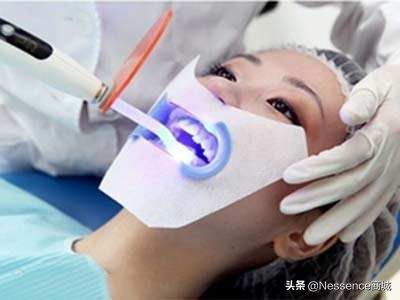 牙齿美白方法,牙齿美白去黄的最快方法