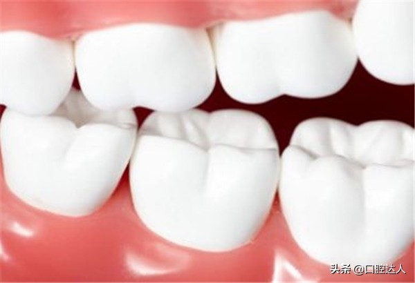 不补牙齿有问题吗,不补牙齿后牙齿会怎样