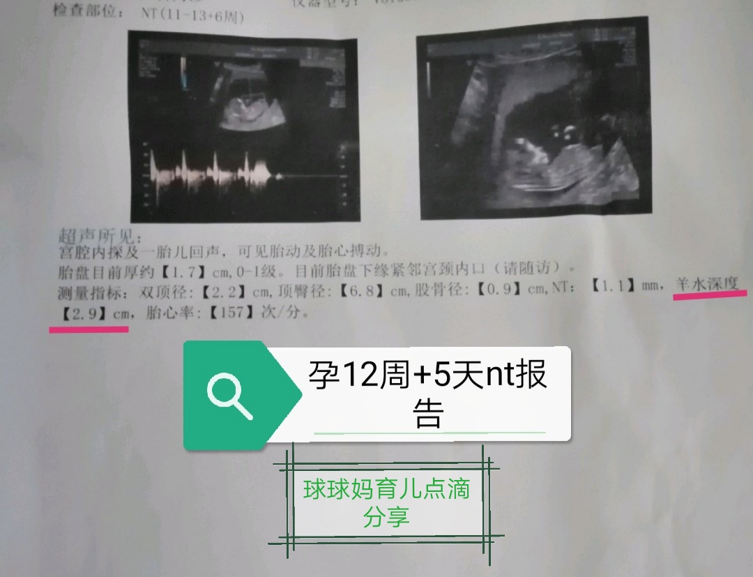 孕期报告单大全,孕期检查报告有哪些