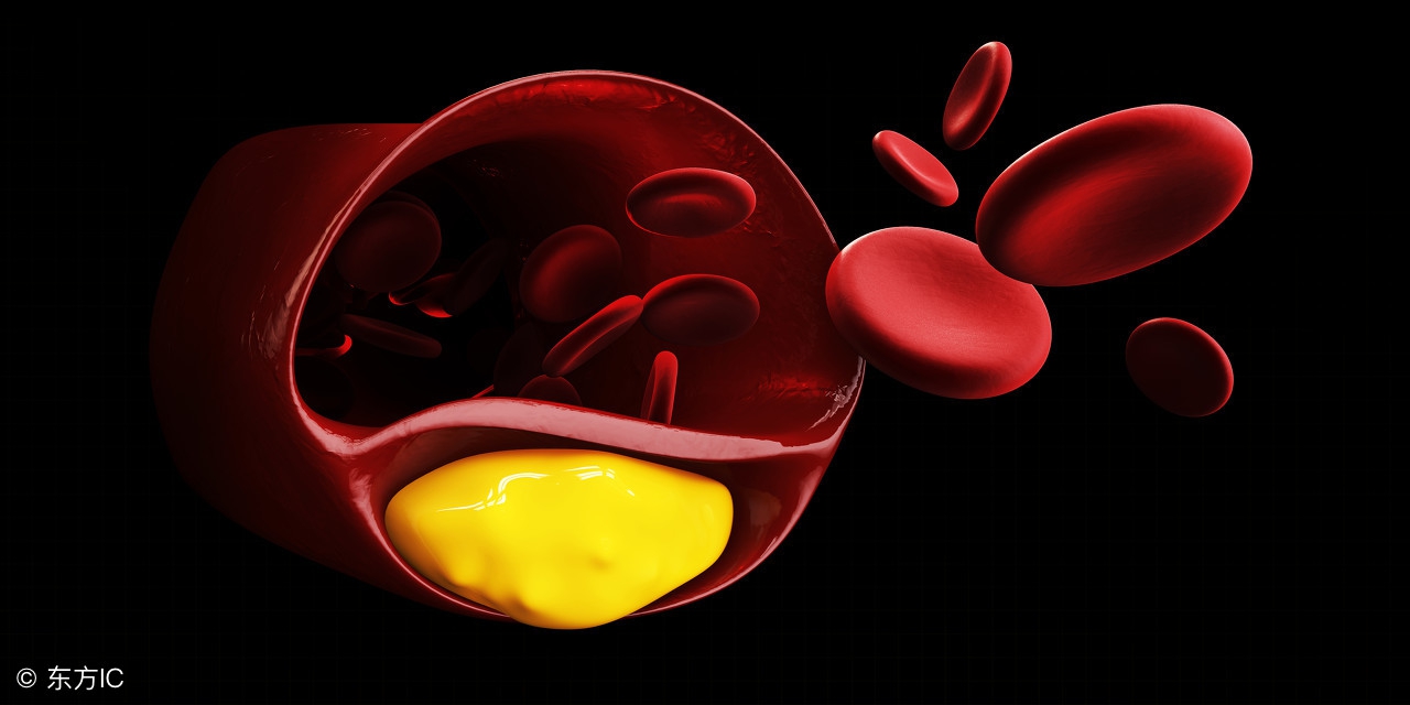 老年人的血压高压160低压80可以吗,低压80高压160正常吗降压药有哪些