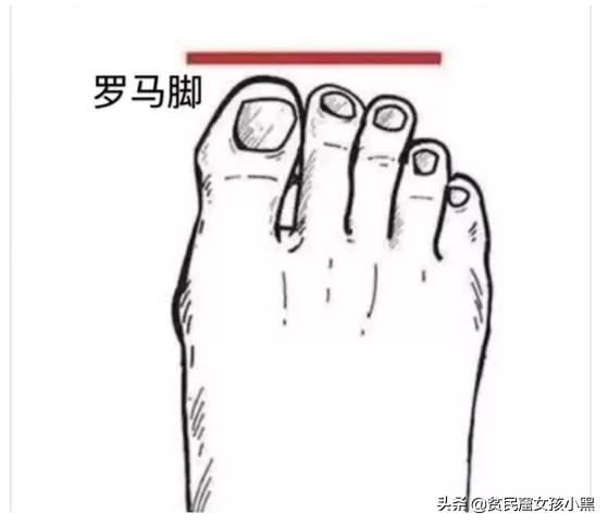 脚胖穿什么高跟凉鞋好看,脚丑穿什么凉鞋好看