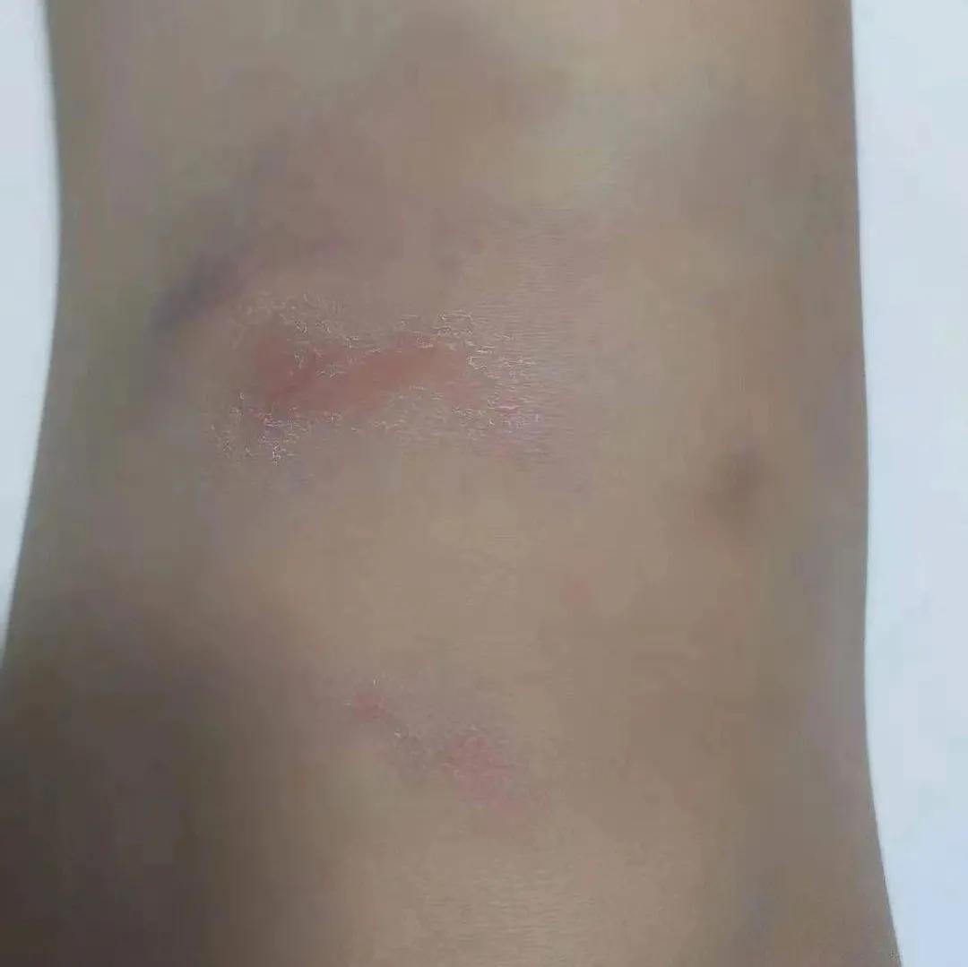 天使日记完整版196,天使日记武汉救援令人泪目