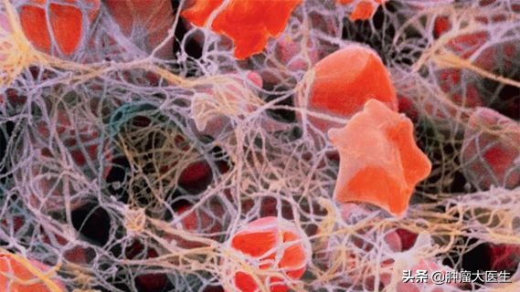 6项肿瘤标志物检测竟能查出数十种问题