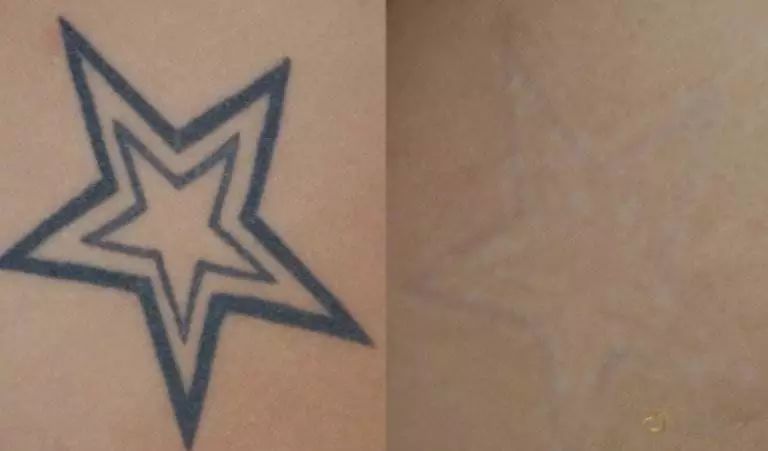 清洗纹身一般要几次,清洗纹身后需要注意什么