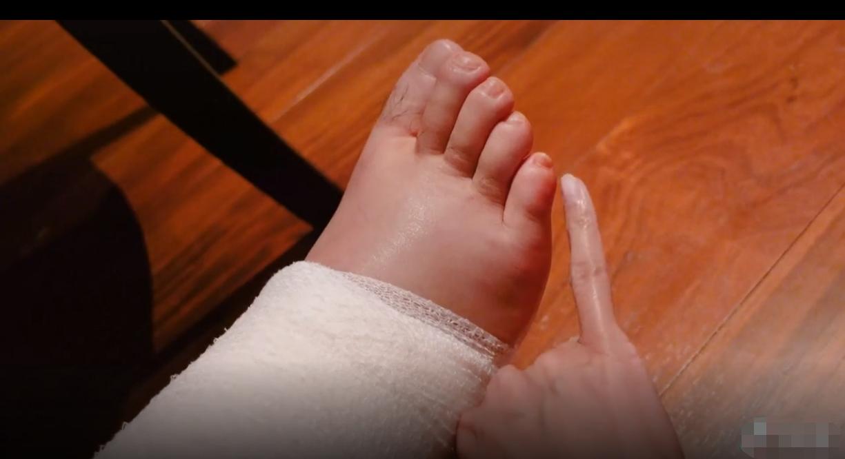 陈赫手术后出院依然逗笑众人,陈赫张子萱产后出院