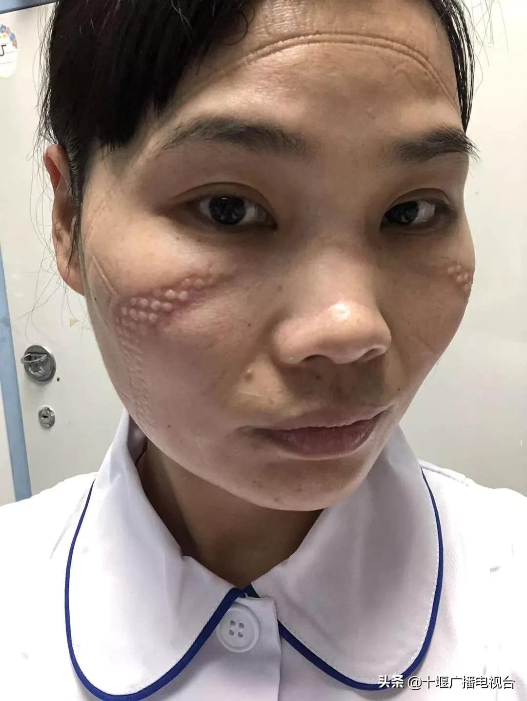 战疫日记同心协力共迎胜利,战疫日记疫情高发期