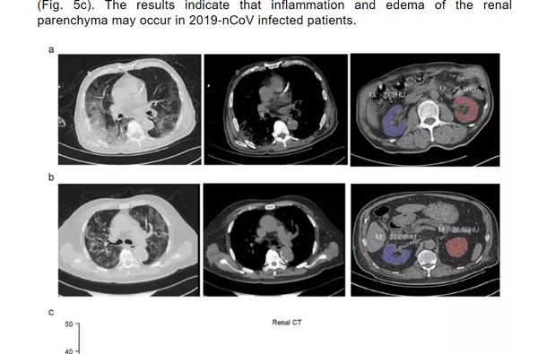 新冠后遗症有多严重损伤,新冠后遗症严重视频