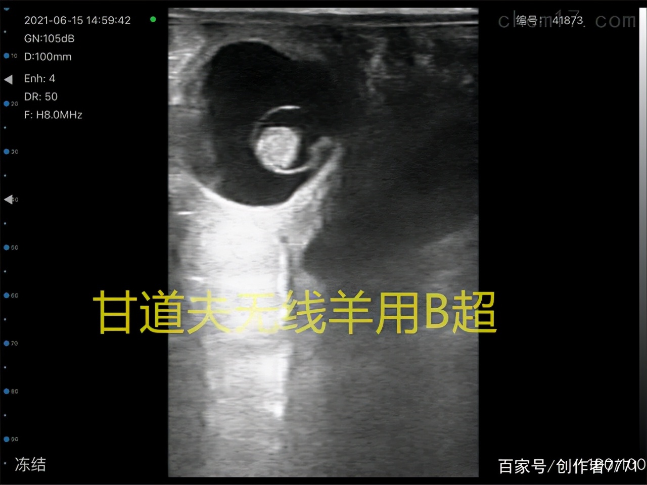 高清驴用B超马用B超测孕方法图像分析判断教程