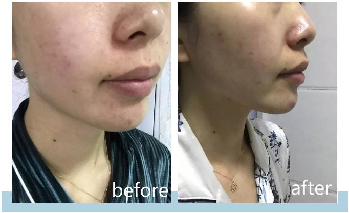 紫檀真的抗衰老吗,紫檀能扩香吗