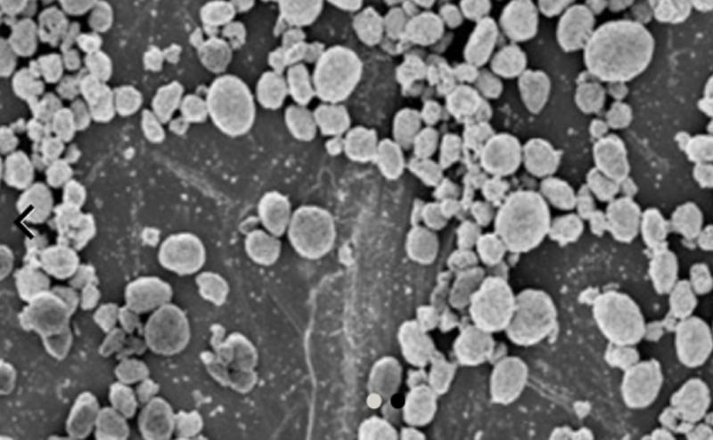 纳米牙膏能修复手机划痕是真的吗,牙膏真的可以消掉手机划痕吗