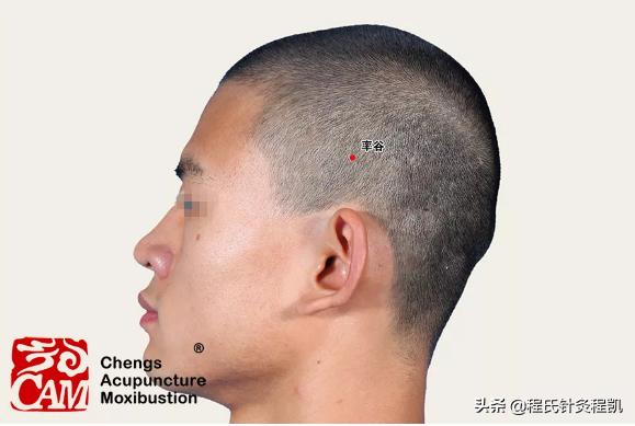 面神经炎中医诊断,面神经炎中医名称