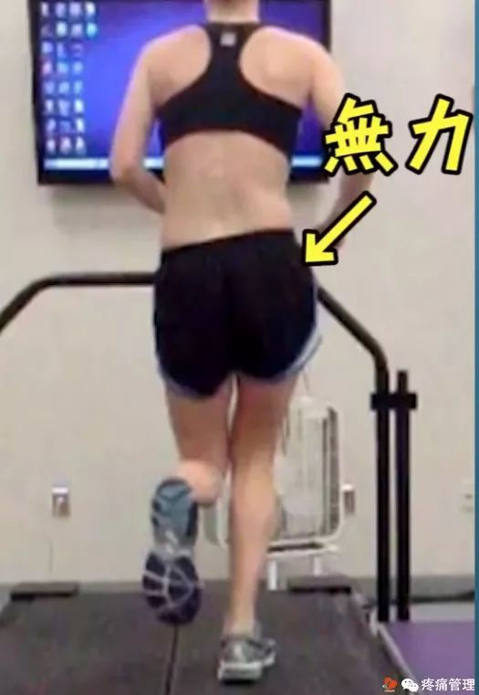 走路屁股扭来扭去是种病，还会导致腰痛、脚痛