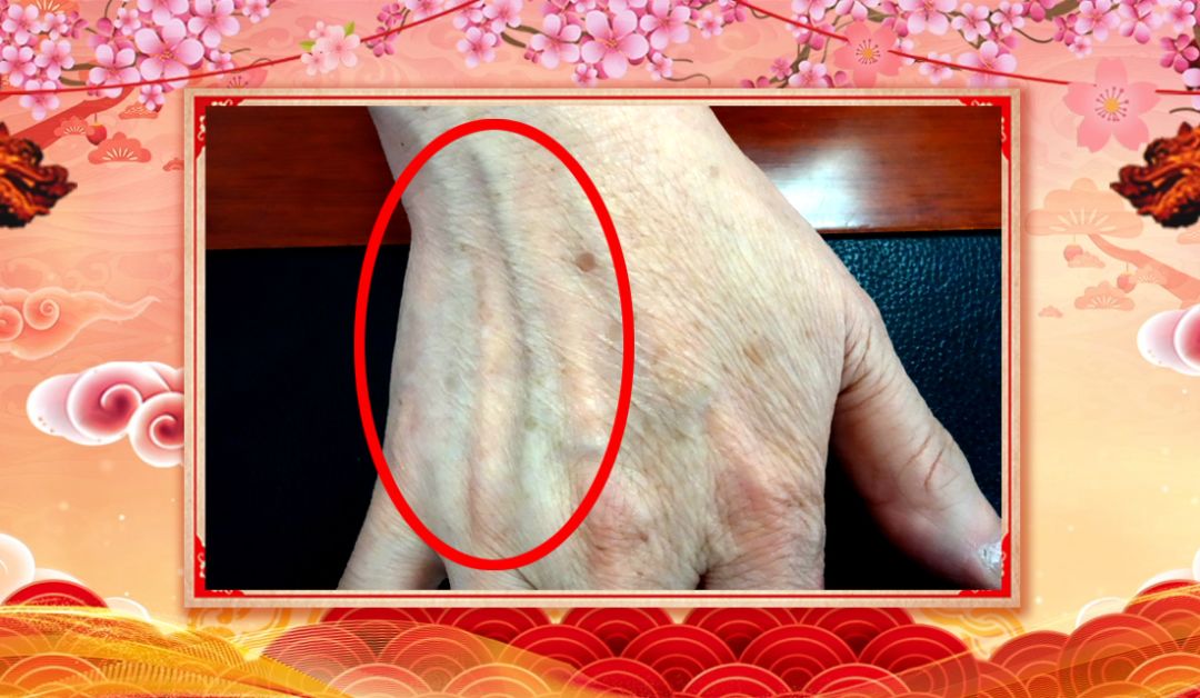 身体好不好,看手就知道!这几处变化可能藏大病