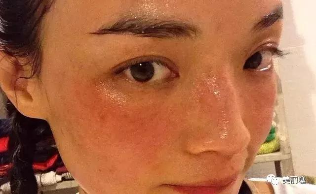 护肤品真的有毒吗,什么牌子的护肤品有毒