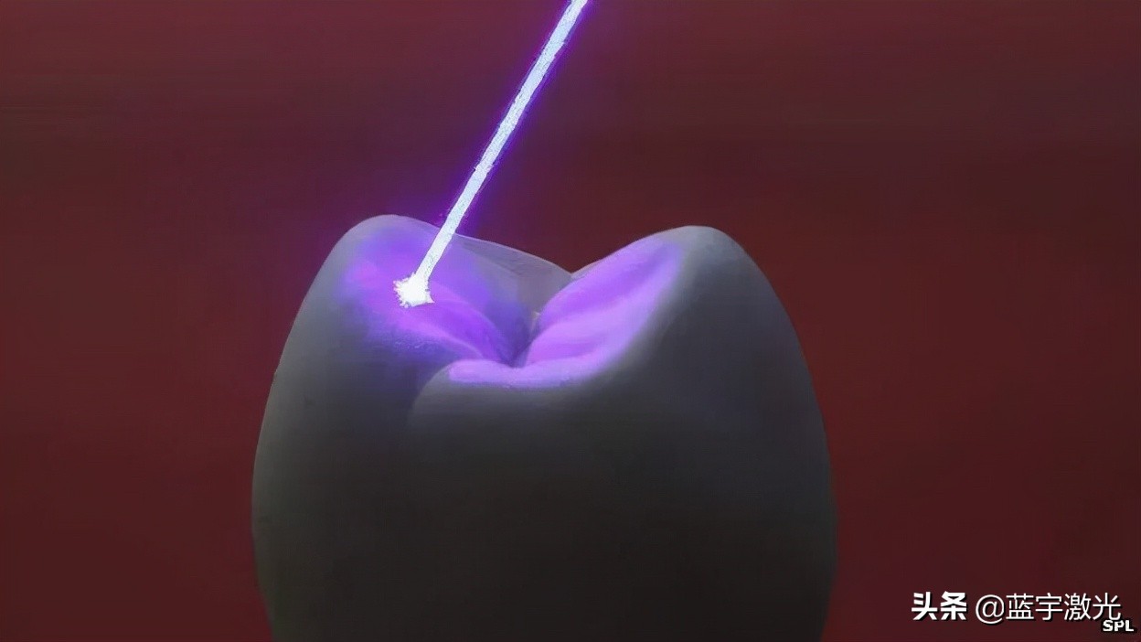 现代激光技术的发展前沿,激光器的发展水平及热点技术