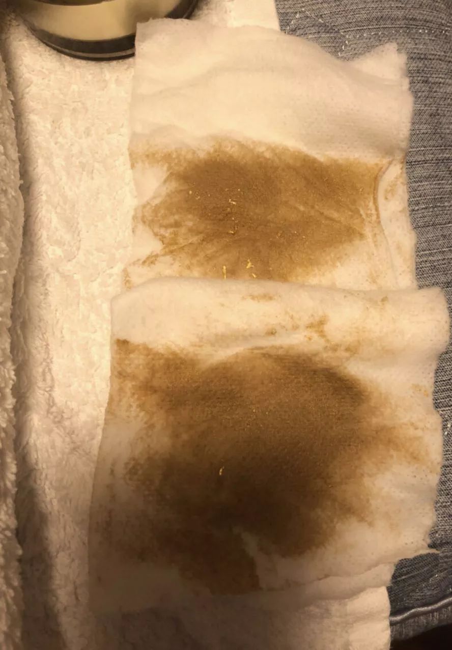 免费体验毛孔清洁图片,脱毛脸部清洁女