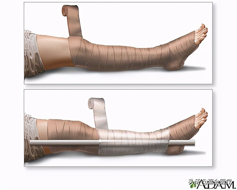 被蛇咬用嘴吸毒,被蛇咬后用嘴吸毒