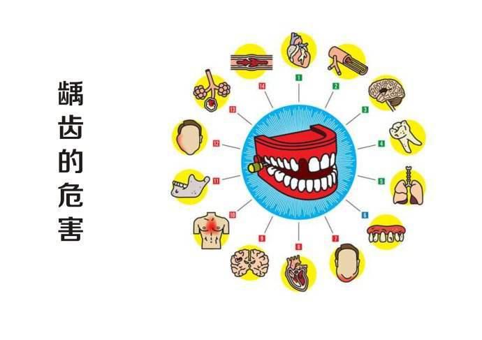 牙齿全部蛀掉了怎么办,牙齿蛀掉了经常牙痛怎么回事