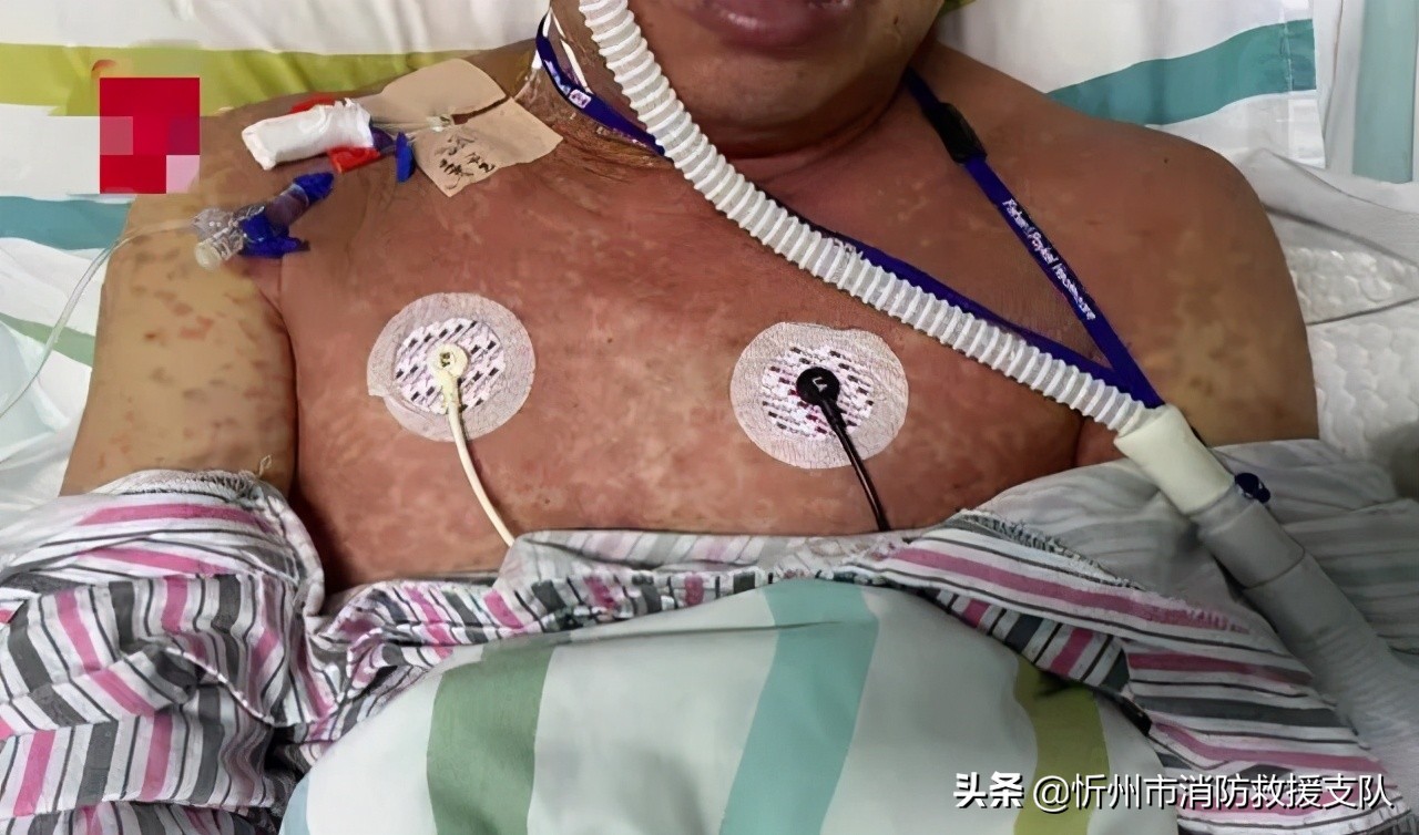 食人蚁袭击人类,一口气看完食人蚁袭击人类