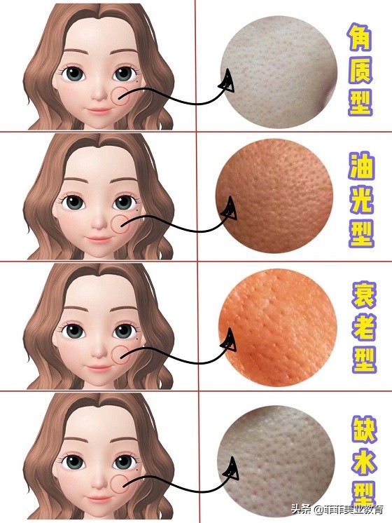 毛孔粗大怎么办教你快速收缩毛孔,毛孔粗大收缩毛孔最有效的方法