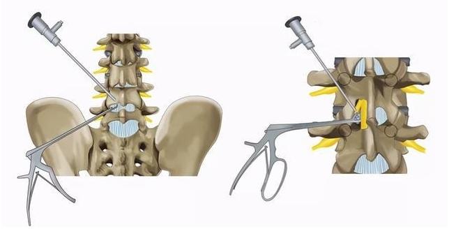 ube技术的起源和发展,ube技术优缺点及费用