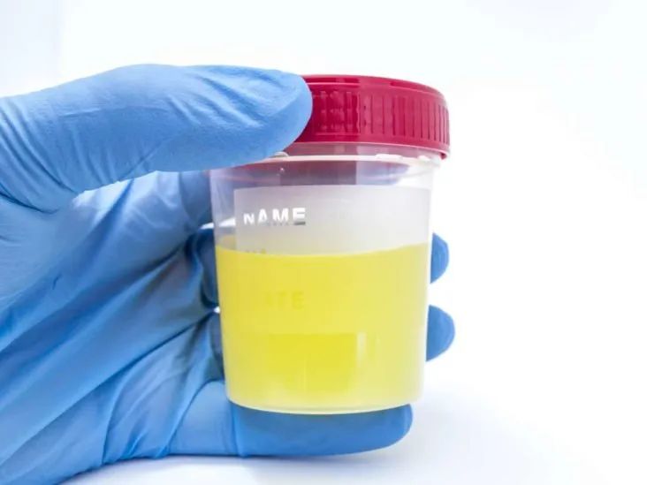 尿黄不是上火，是因为什么？