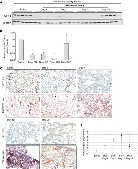 肺纤维化转基因小鼠,fxr基因敲除小鼠