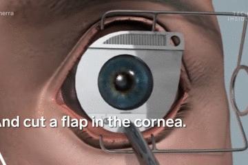 医生手术后最想做什么,医生做完手术以后会怎样