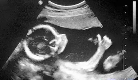 x光b超ct核磁共振区别,ctx光和b超核磁共振的区别