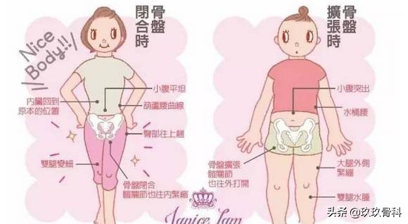 骨盆那些事儿：骨盆错位是女性疾病根源