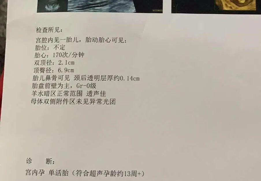 孕期一共做几次b超检查,孕期需要做几次b超检查