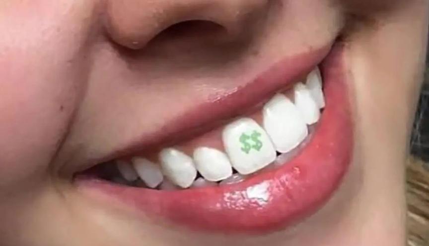 全球流行纹身,牙齿纹身图