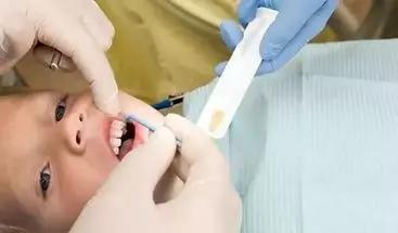 牙齿涂氟小知识,有氟牙可以涂氟吗