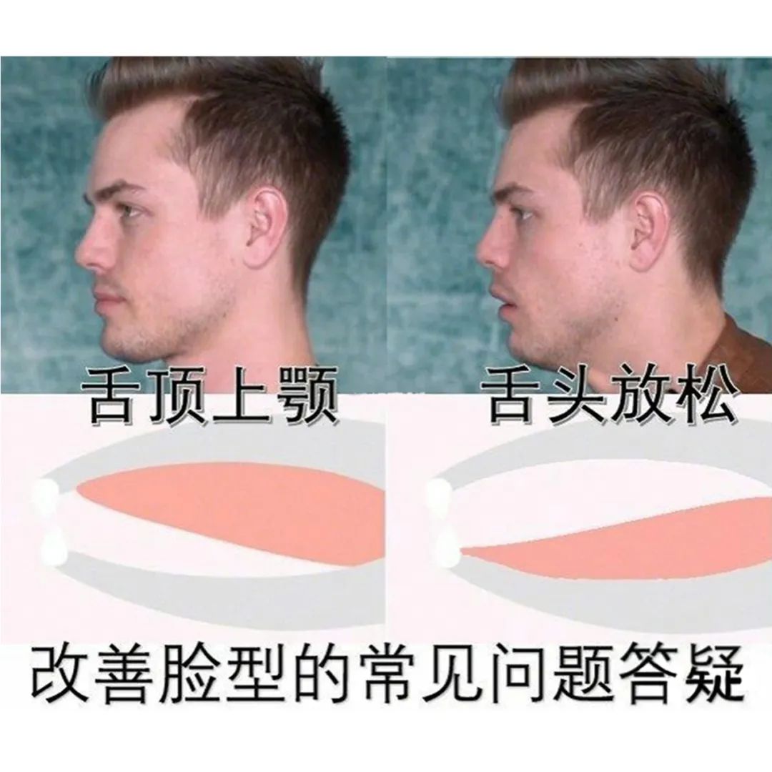 被脸型拖累的颜值,被嘴凸影响的颜值