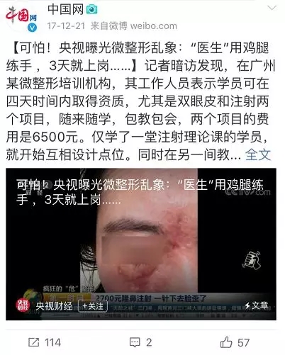 一针维生素b12要多少钱,一针维c