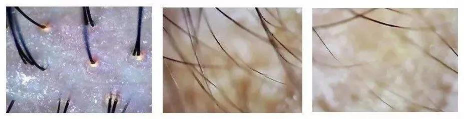 明星亲测有效的护肤品,明星亲测