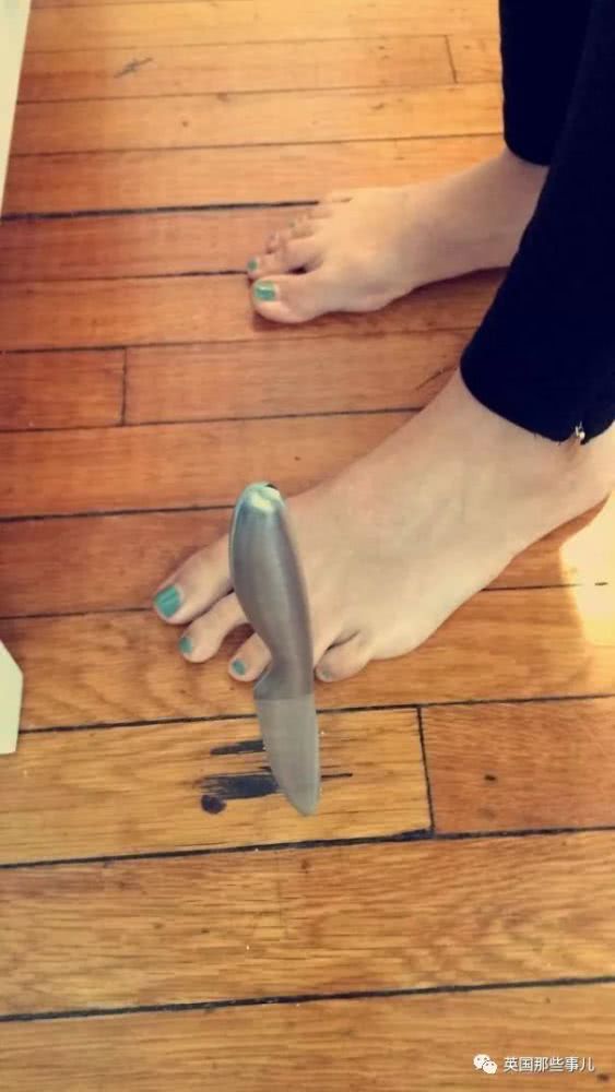 角磨机普通砂轮片爆炸,角磨机砂轮片炸了