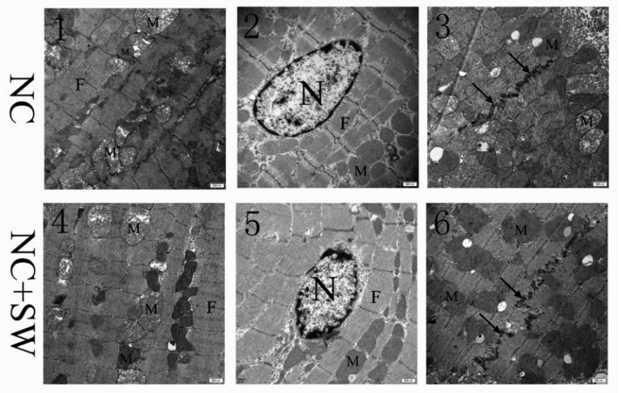 北京协和医院治心脏好吗,体外心脏震波治疗系统