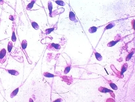 小蝌蚪检测需要多久,小蝌蚪常规报告怎么看