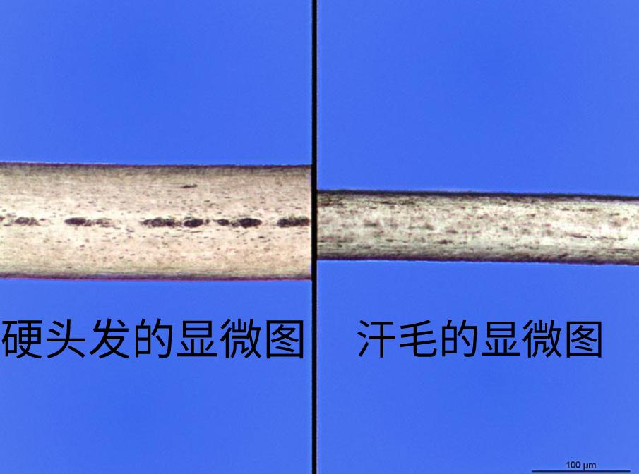 *处私**的毛发对人类到底有什么意义？毛发的作用，背后可能颠覆认知