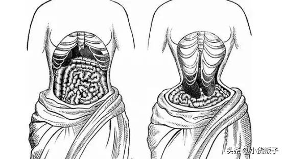内脏下垂、子宫脱落、漏尿…今天和你一起说一说束腰的危害