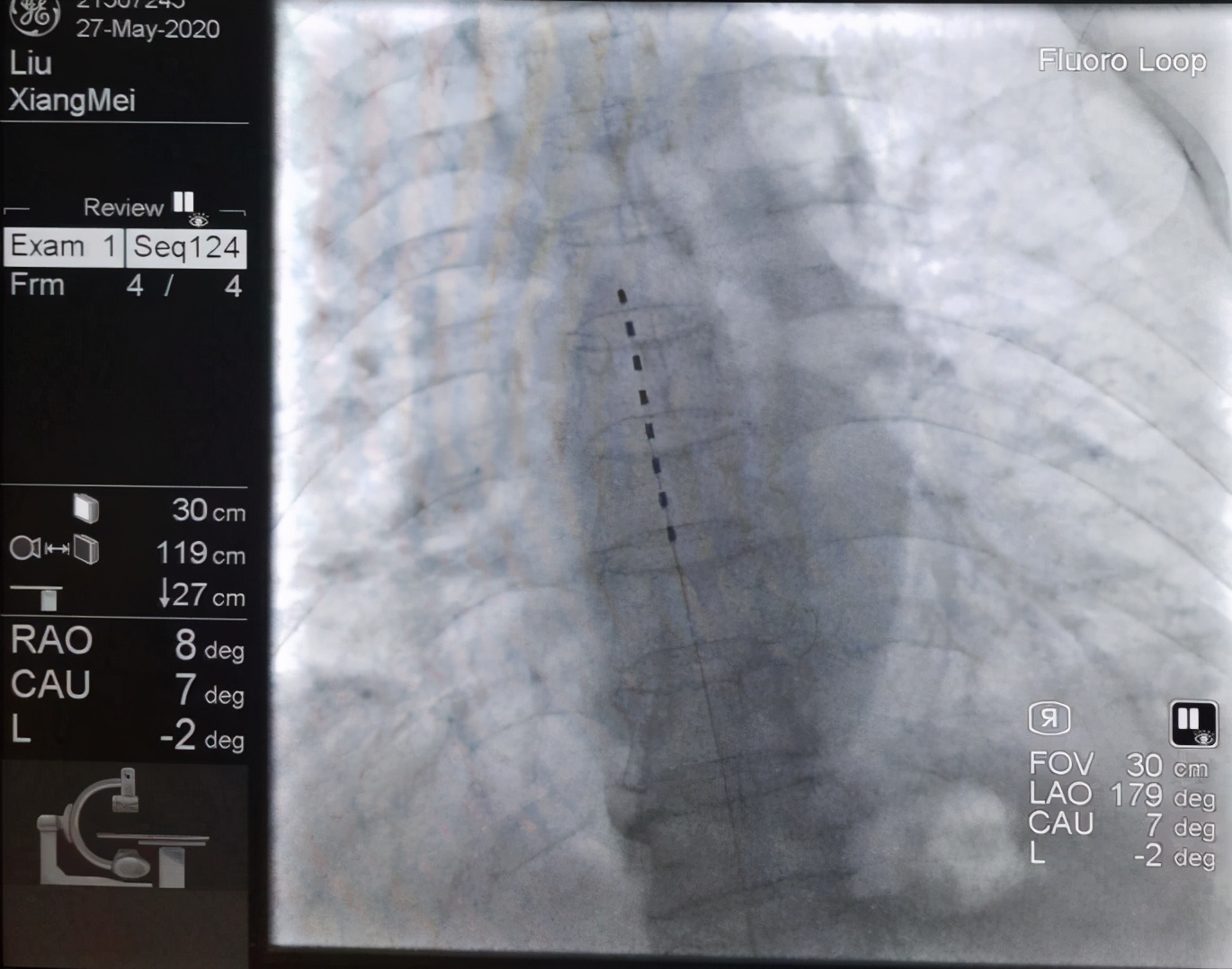 赶走疼痛,一身轻松!腰背痛,太原市中心医院疼痛科有妙招