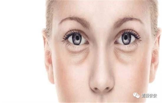 解决眼部干纹黑眼圈最好的方法,黑眼圈眼袋干纹怎么消除
