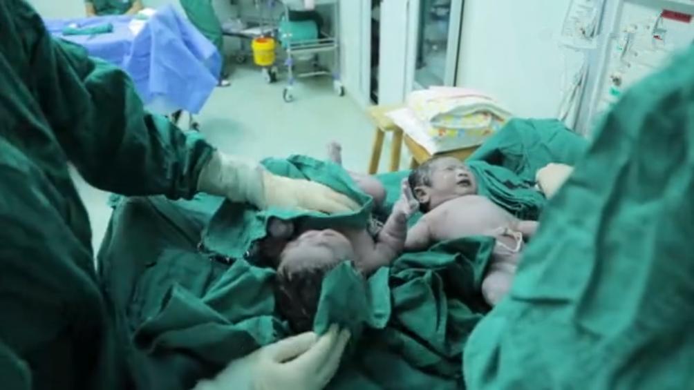 北大医院妇产科历史,北大医院妇产科产妇