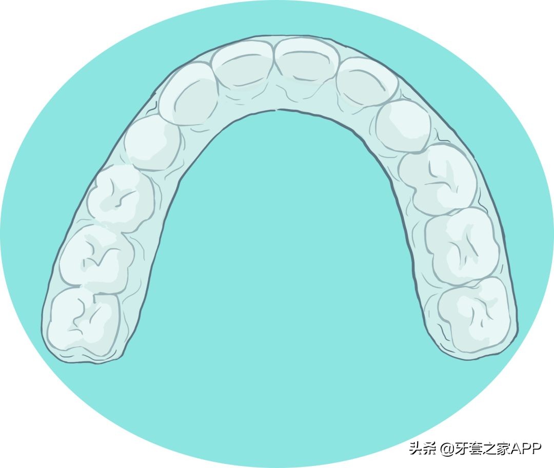 疫情时牙套遇到突发情况怎么办？应对办法在这里